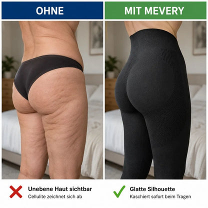 Mevery – Kompressionsleggings